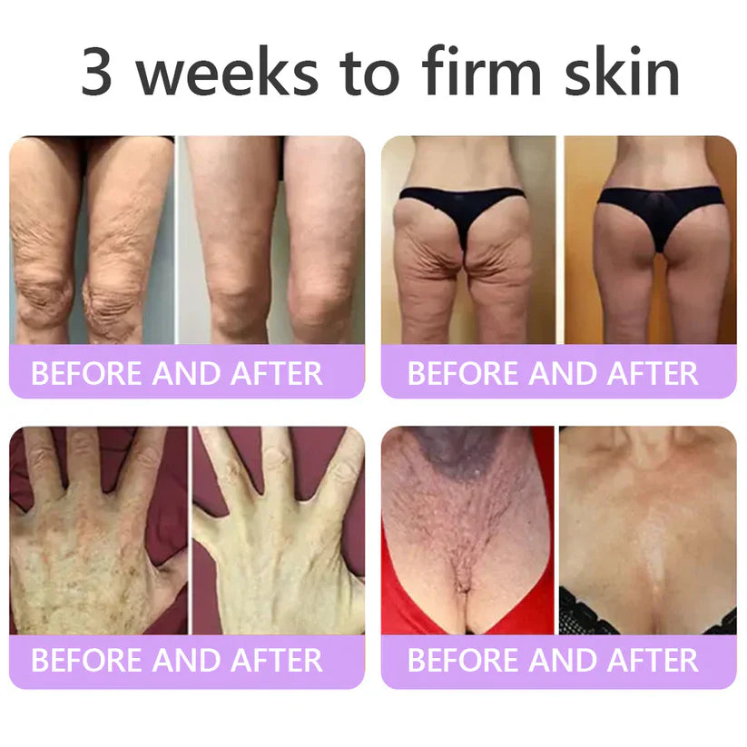 ✨LAST DAY BUY 1 GET 1 FREE✨ HISKIN PDRN Multi-Peptide Massaging Body RollerCream Visibly Firmer Anti-aging, Lifted Skin in 72 Hours — No Needles, No Clinic Visits