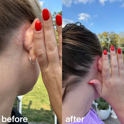 🏆Flash Sale⚡Revive + Restore Scalp Scrub