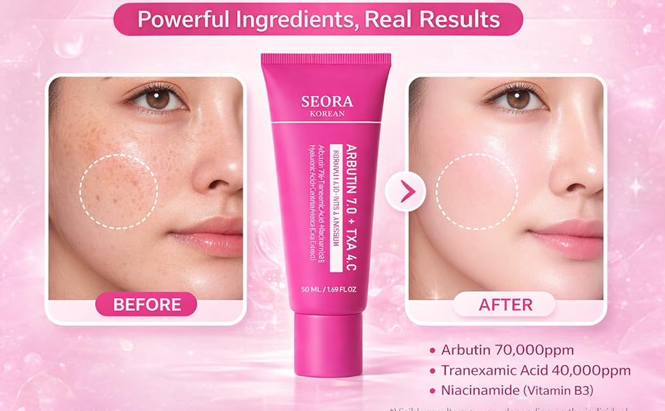 🔥Limited Time Offer🔥Tranexamic Acid Cream for Face & Body