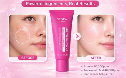 🔥Limited Time Offer🔥Tranexamic Acid Cream for Face & Body