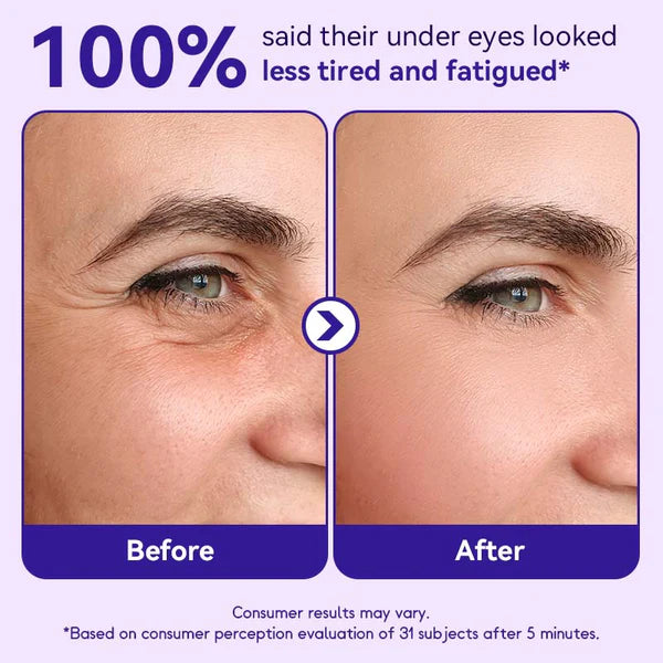 🔥Instant Lift Eye Gel🔥 — Reduce the Look of Eye Bags in Minutes