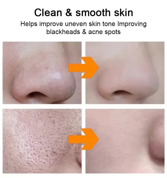 🔥Buy 1 get 1 free🔥 Orange Enzyme Exfoliating Gel 50g – Facial Cleansing Peel