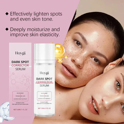 🔥Limited Time Offer🔥Advanced Dark Spot Corrector Serum -Multi-Correction Brightening Formulafor Sun Spots, Age Spots, and Melasma-XXS