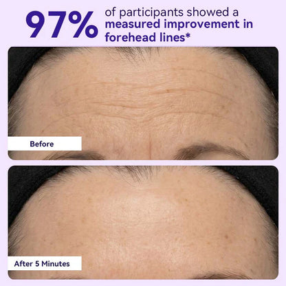 🔥Instant Lift Eye Gel🔥 — Reduce the Look of Eye Bags in Minutes