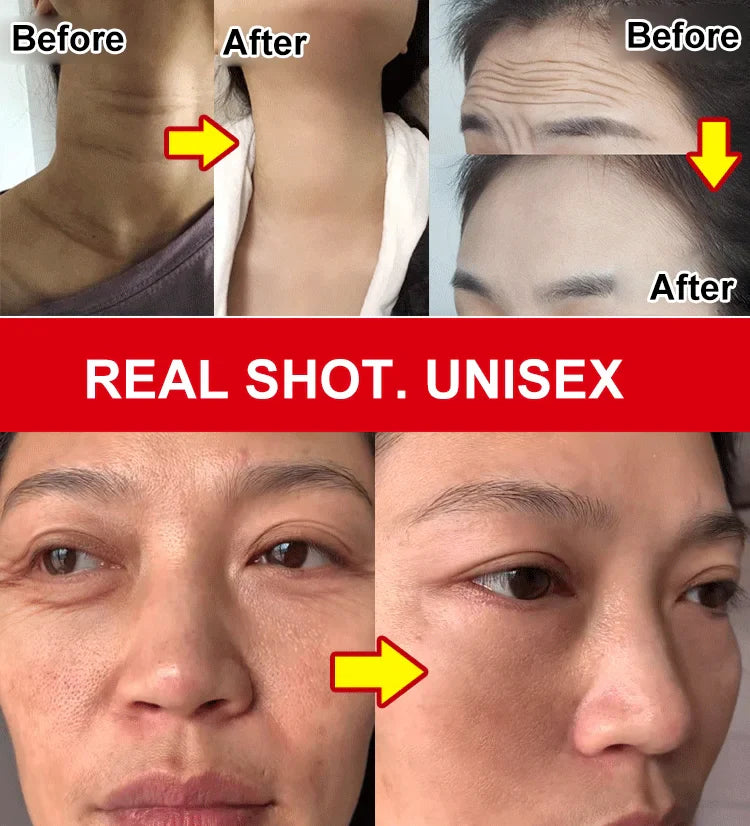 💥BUY 1 GET 1 FREE💥Rejuvenating Anti Wrinkle Cream