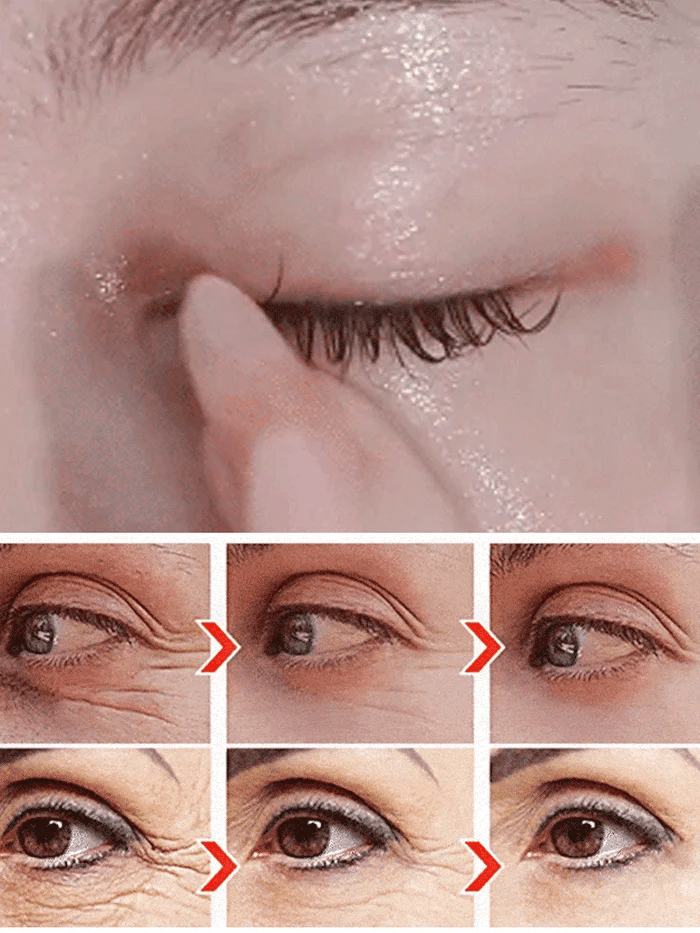 🔥BUY 1 GET 1 FREE🔥Anti-wrinkle eye serum oil