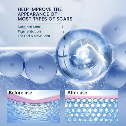 🔥LAST DAY DISCOUNT 🔥SUMIFUN TEXTURE REPAIR GEL