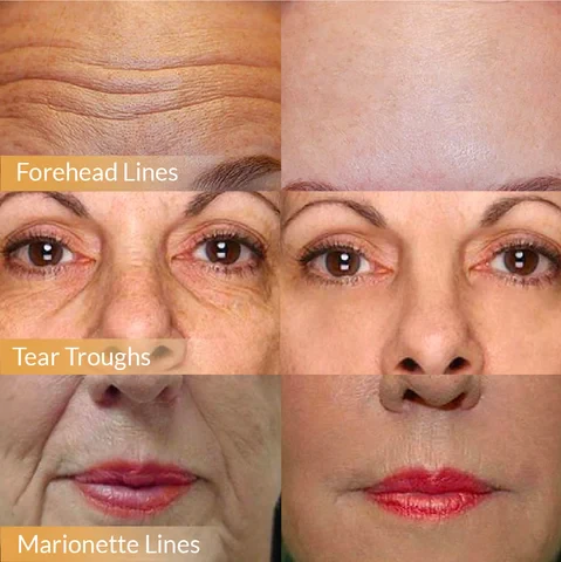 🎁BUY 1 GET 1 FREE🎁POLYPEPTIDE FIRMING FULL FACE CREAM-CHANGE FOR BEAUTIFUL SKIN WITHIN 2 WEEKS