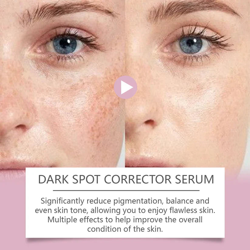🔥Limited Time Offer🔥Advanced Dark Spot Corrector Serum -Multi-Correction Brightening Formulafor Sun Spots, Age Spots, and Melasma-XXS