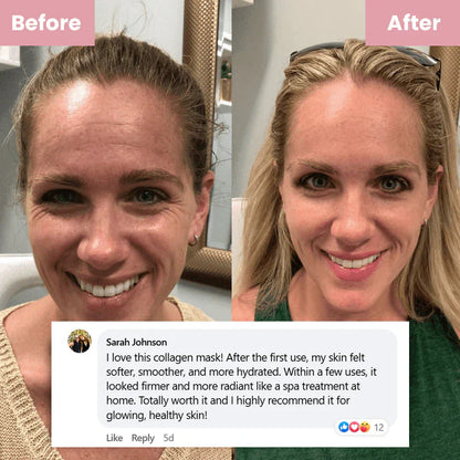 🔥Buy 2 Collagen Night Masks, Get 1 Free!🔥 Wake Up to Youthful, Hydrated Skin!