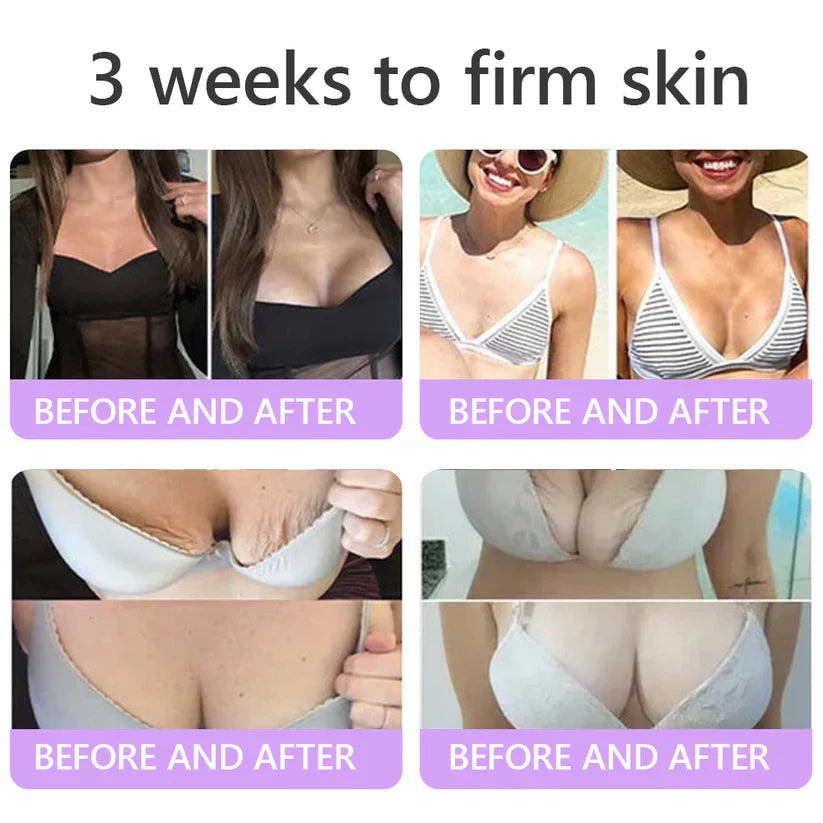 ✨LAST DAY BUY 1 GET 1 FREE✨ HISKIN PDRN Multi-Peptide Massaging Body RollerCream Visibly Firmer Anti-aging, Lifted Skin in 72 Hours — No Needles, No Clinic Visits