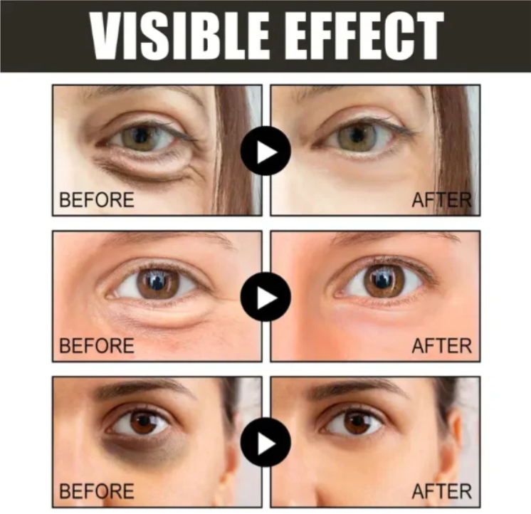 🔥Buy 1 Get 1 Free🔥New Retinol Caffeine Anti-Wrinkle Stay-Up Late Eye CREAM