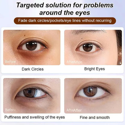 🔥BUY 1 GET 1 FREE🔥Anti-wrinkle eye serum oil