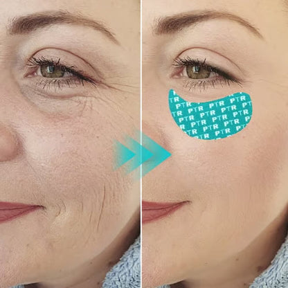 💚 LAST DAY BUY 1 GET 1 FREE✨Peter Thomas Roth Peptide Skinjection Peptide Infused Face + Eye Tape