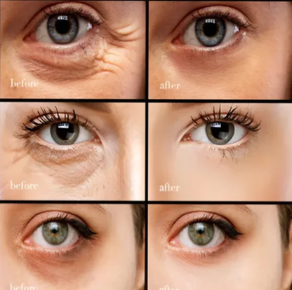 🔥Buy 1 Get 1 Free🔥New Retinol Caffeine Anti-Wrinkle Stay-Up Late Eye CREAM
